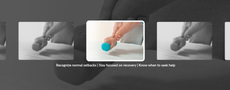 Post-Surgical Setbacks Are Normal: Here Is How to Recognize Them and Keep Your Recovery Moving